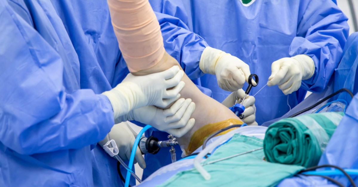 Cirurgia Artroscópica da Luxação Glenoumeral