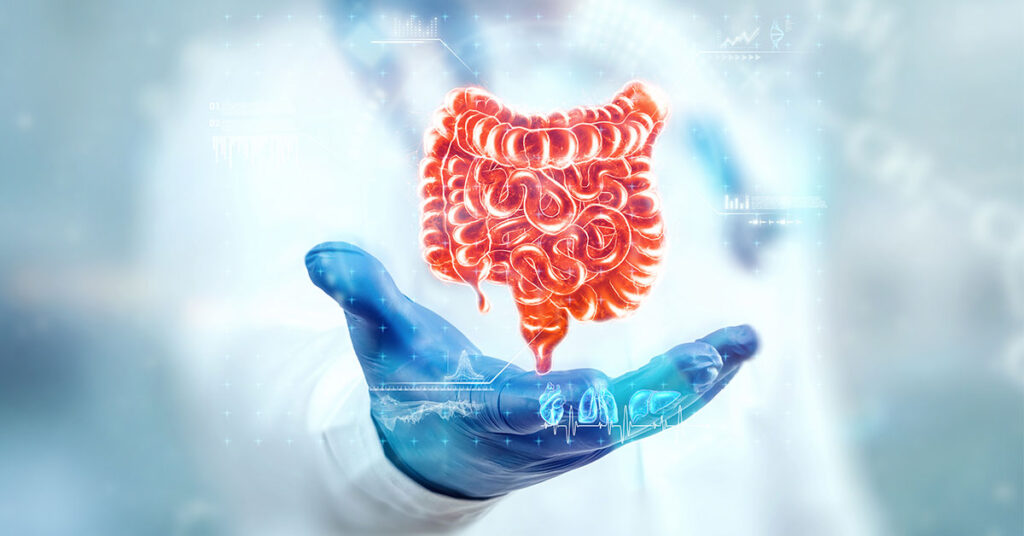 Adenocarcinoma